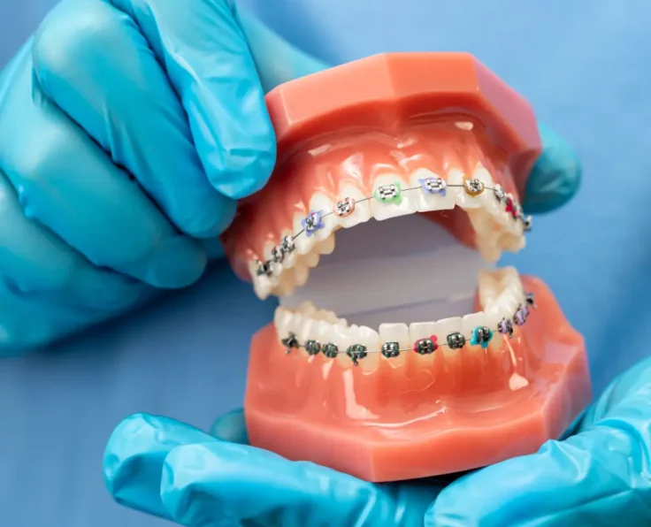 Best Orthodontist Edmonton